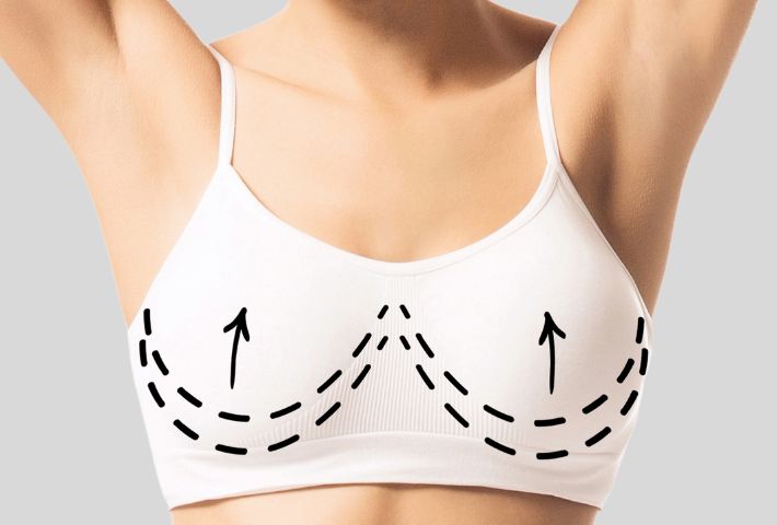 Breast lift menu item