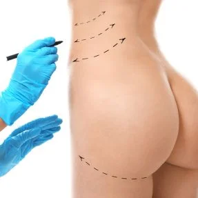 Body-Lift-technique-montreal