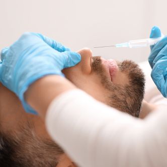 Nasal filler injection for nonsurgical rhinoplasty